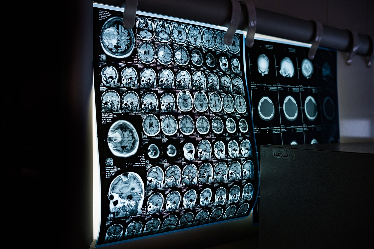Jak długo trwa badanie MRI