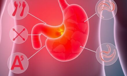 Choroba wrzodowa: objawy, przyczyny, diagnostyka i leczenie
