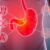 Choroba wrzodowa: objawy, przyczyny, diagnostyka i leczenie