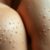 Rogowacenie okołomieszkowe – przyczyny, objawy i leczenie tej dermatozy