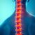Leczenie chorób kręgosłupa: objawy, diagnostyka i terapie