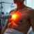 Laseroterapia – jak działa i jakie ma korzyści w rehabilitacji?