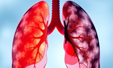 Choroby obturacyjne: przyczyny, objawy i diagnostyka POChP